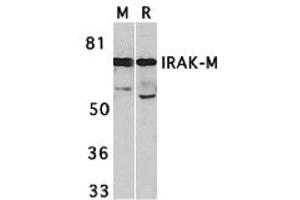 Western Blotting (WB) image for anti-Interleukin-1 Receptor-Associated Kinase 3 (IRAK3) (C-Term) antibody (ABIN1030446)