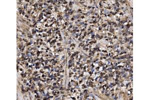 IHC analysis of ADRM1/ARM-1 using anti-ADRM1/ARM-1 antibody (ABIN7600108).