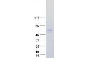 Validation with Western Blot