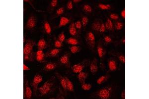 IF analysis of FLI1 using anti-FLI1 antibody (ABIN7599409). (FLI1 anticorps  (AA 1-452))