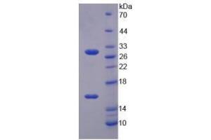 Image no. 1 for Sirtuin 3 (SIRT3) (AA 5-257) (Active) protein (His tag) (ABIN6239915)