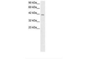 Image no. 1 for anti-SMAD, Mothers Against DPP Homolog 3 (SMAD3) (N-Term) antibody (ABIN202493)