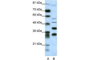 WB Suggested Anti-GFI1 Antibody Titration: 0. (GFI1 anticorps  (N-Term))