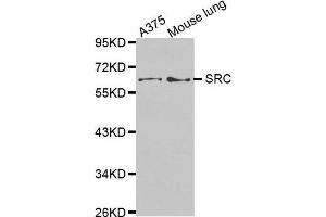 Western Blotting (WB) image for anti-Proto-oncogene tyrosine-protein kinase Src (Src) (AA 410-536) antibody (ABIN1682877)