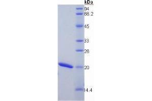 SDS-PAGE analysis of Mouse Cyclophilin B Protein.