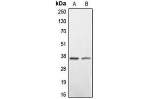 Western blot analysis of BNIP2 expression in HEK293T (A), mouse liver (B) whole cell lysates.
