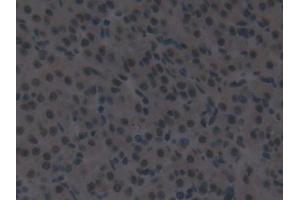 Detection of IRF2 in Mouse Ovary Tissue using Polyclonal Antibody to Interferon Regulatory Factor 2 (IRF2) (IRF2 anticorps  (AA 1-349))