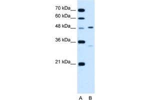 Western Blotting (WB) image for anti-Carbohydrate (Keratan Sulfate Gal-6) Sulfotransferase 1 (CHST1) antibody (ABIN2462855) (CHST1 anticorps)