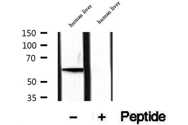 PIP5K1A 抗体  (N-Term)