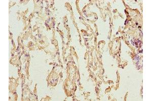 Immunohistochemistry of paraffin-embedded human lung tissue using ABIN7173119 at dilution of 1:100