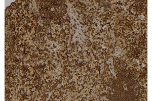 ABIN6262123 and ABIN6277531 at 1/100 staining Rat spleen tissue by IHC-P.