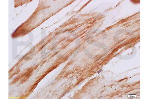 Formalin-fixed and paraffin embedded rat skeletal muscle labeled with Anti-F-Actin Polyclonal Antibody, Unconjugated (ABIN731498) at 1:200, followed by conjugation to the secondary antibody and DAB staining (F-Actin anticorps  (AA 1-50))