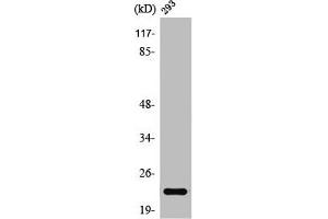 Western Blot analysis of 293 cells using Rab 35 Polyclonal Antibody (RAB35 anticorps  (Internal Region))