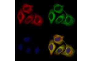 ABIN6264314 and ABIN6274038 staining Hela cells by IF/ICC. (Melanoma gp100 anticorps  (C-Term))