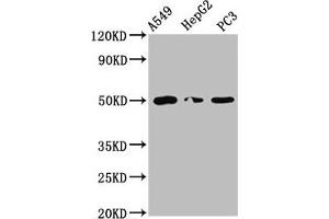 Western Blot Positive WB detected in: A549 whole cell lysate, HepG2 whole cell lysate, PC-3 whole cell lysate All lanes: IFT52 antibody at 5. (IFT52 anticorps  (AA 325-434))