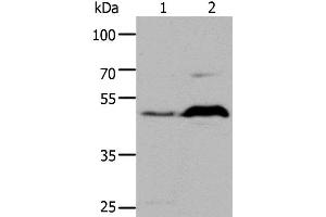 Western Blot analysis of HepG2 cell and Mouse brain tissue using HTR1A Polyclonal Antibody at dilution of 1:1000 (Serotonin Receptor 1A anticorps)