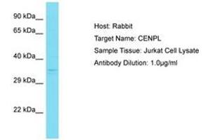 Image no. 1 for anti-Centromere Protein L (CENPL) (AA 108-157) antibody (ABIN6750824) (CENPL anticorps  (AA 108-157))