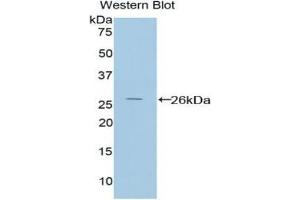 Western blot analysis of the recombinant protein. (PICK1 anticorps  (AA 24-229))