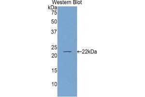 WB of Protein Standard: different control antibodies against Highly purified E. (ENOS Kit ELISA)