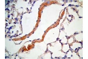 Mouse lung cancer tissue stained by Rabbit Anti-CRAMP  Antibody