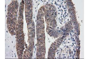 Image no. 3 for anti-Destrin (Actin Depolymerizing Factor) (DSTN) antibody (ABIN1497907)