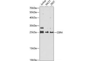 Western blot analysis of extracts of various cell lines using CBR4 Polyclonal Antibody at dilution of 1:1000. (CBR4 anticorps)