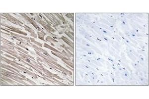 Immunohistochemistry analysis of paraffin-embedded human heart tissue, using MRPL44 Antibody.