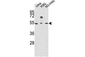 Western blot analysis of APOA4 antibody and Jurkat, K562, NCI-H460 lysate (APOA4 anticorps  (AA 49-79))