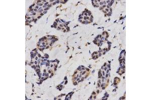 Immunohistochemistry (IHC) image for anti-Regulator of Calcineurin 1 (RCAN1) antibody (ABIN1876514) (RCAN1 anticorps)