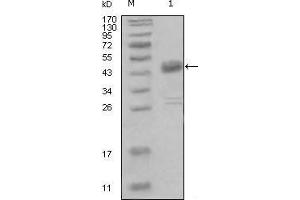 Western Blot showing DDR1 antibody used against truncated MBP-DDR1 recombinant protein (1). (DDR1 anticorps  (AA 602-681))