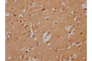 IHC image of ABIN7142045 diluted at 1:200 and staining in paraffin-embedded human brain tissue performed on a Leica BondTM system. (Phospholipase C beta 2 anticorps  (AA 1031-1185))