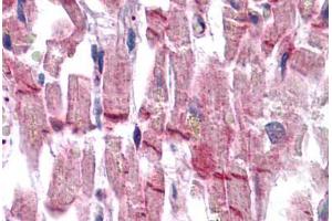 Human Heart: Formalin-Fixed, Paraffin-Embedded (FFPE)