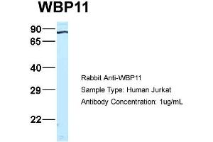 Host:  Rabbit  Target Name:  WB Sample Type:  Jurkat  Antibody Dilution:  1. (WBP11 anticorps  (N-Term))