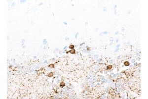 Immunohistochemistry (IHC) image for anti-Tyrosine Hydroxylase (TH) (AA 450-500) antibody (ABIN7449433) (Recombinant Tyrosine Hydroxylase anticorps  (AA 450-500))