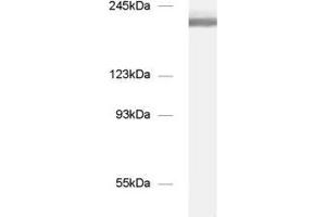 dilution: 1 : 1000, sample: mouse brain homogenate (NCAM 180 (AA 1-1115) anticorps)