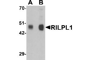 Western blot analysis of RILPL1 in rat cerebellum tissue lysate with RILPL1 antibody at (A) 0.