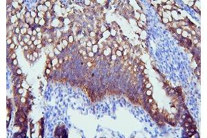 IHC analysis of PYROXD1 using anti-PYROXD1 antibody (ABIN6719650). (PYROXD1 anticorps  (AA 48-230))