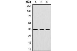 Western blot analysis of Cathepsin V expression in HeLa (A), mouse kidney (B), rat kidney (C) whole cell lysates. (Cathepsin L2 anticorps  (Center))