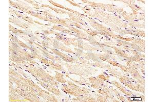 Formalin-fixed and paraffin embedded rat heart tissue labeled with Anti-phospho-ASK1(Thr845) Polyclonal Antibody, Unconjugated (ABIN683128) at 1:200 followed by conjugation to the secondary antibody, (SP-0023), and DAB staining (ASK1 anticorps  (pThr845))