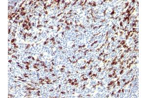 Formalin-fixed, paraffin-embedded human Tonsil stained with PD1 (CD279) Rabbit Polyclonal Antibody.