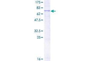 Image no. 1 for Phospholipid Transfer Protein (PLTP) (AA 19-441) protein (GST tag) (ABIN1315481)