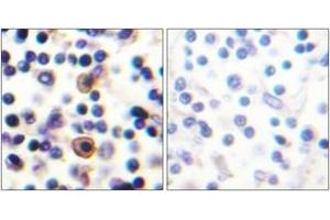 Immunohistochemistry analysis of paraffin-embedded human lymph node, using IL-9R (Phospho-Ser519) Antibody.