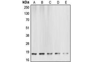 Western blot analysis of Caspase 6 p18 expression in HeLa (A), mouse brain (B), rat kidney (C), NIH3T3 staurosporine-treated (D), Jurkat etoposide-treated (E) whole cell lysates. (Caspase 6 p18 (Center) anticorps)