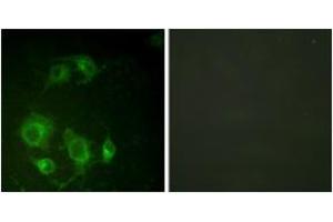 Immunofluorescence analysis of HuvEc cells, using EGFR (Ab-693) Antibody. (EGFR anticorps  (AA 661-710))