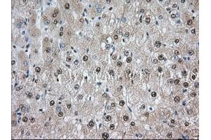 Image no. 8 for anti-Transforming, Acidic Coiled-Coil Containing Protein 3 (TACC3) antibody (ABIN1498097) (TACC3 anticorps)