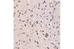 Immunohistochemistry of paraffin embedded rat brain using SRP14 (ABIN7075596) at dilution of 1:300 (400x lens)