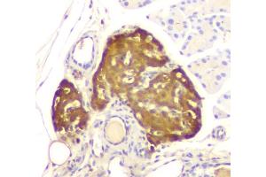 IHC analysis of ATP citrate lyase using anti-ATP citrate lyase antibody (ABIN6719406).