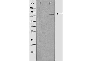 Western blot analysis of Hela whole cell lysates, using MSH3 Antibody. (MSH3 anticorps  (N-Term))