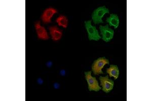 Phospho-eIF4B (Ser504) Antibody staining Hela cells(heat shock treatment) by IF/ICC. (EIF4B anticorps  (pSer504))