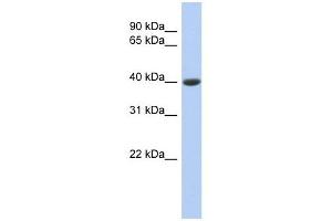 Carboxypeptidase B1 antibody used at 1 ug/ml to detect target protein.